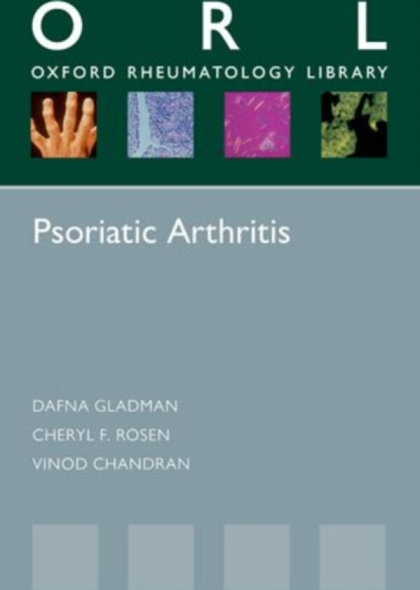 Psoriatic Arthritis av Dafna Gladman, Cheryl F. Rosen, Vinod Chandran (Paperback)