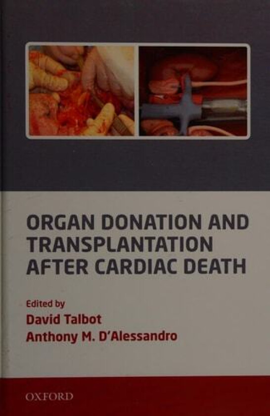Organ Donation and Transplantation after Cardiac Death av David Talbot, Anthony D'Alessandro (Hardcover)
