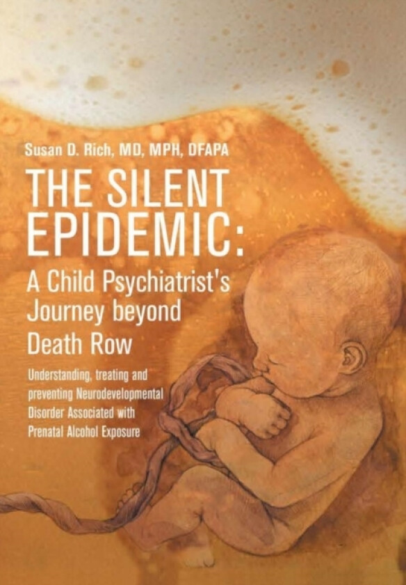 The Silent Epidemic av Mph MD Rich (Hardcover)