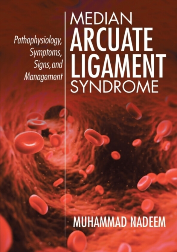 Median Arcuate Ligament Syndrome av Muhammad Nadeem (Paperback)