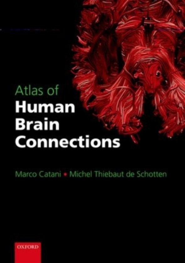 Atlas of Human Brain Connections av Marco Catani, Michel Thiebaut de Schotten (Paperback)