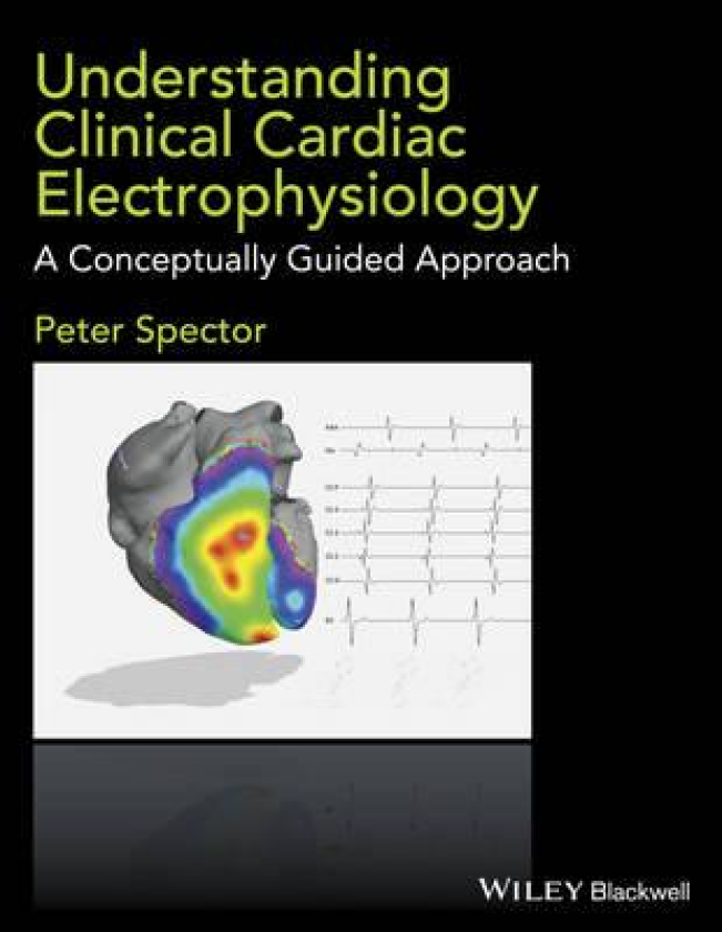 Understanding Clinical Cardiac Electrophysiology A Conceptually Guided Approach