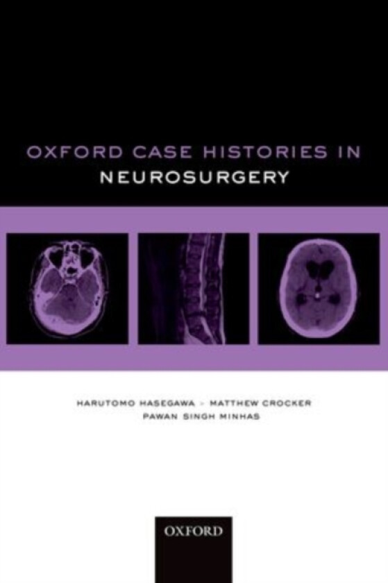Oxford Case Histories in Neurosurgery av Harutomo Hasegawa, Matthew Crocker, Pawan Singh Minhas (Paperback)