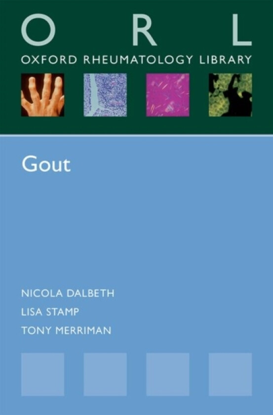 Gout av Nicola Dalbeth, Lisa Stamp, Tony Merriman (Paperback)