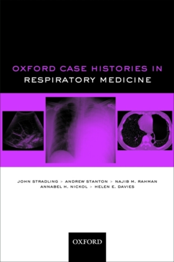 Oxford Case Histories in Respiratory Medicine av John Stradling, Andrew Stanton, Najib M. Rahman (Paperback)