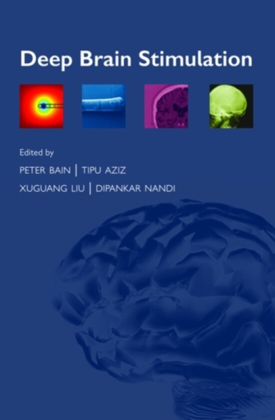 Deep Brain Stimulation av Peter Bain, Tipu Aziz, Xuguang Liu (Paperback)