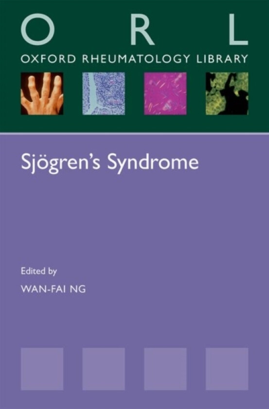 Sjogren's Syndrome av Wan-Fai Ng (Paperback)