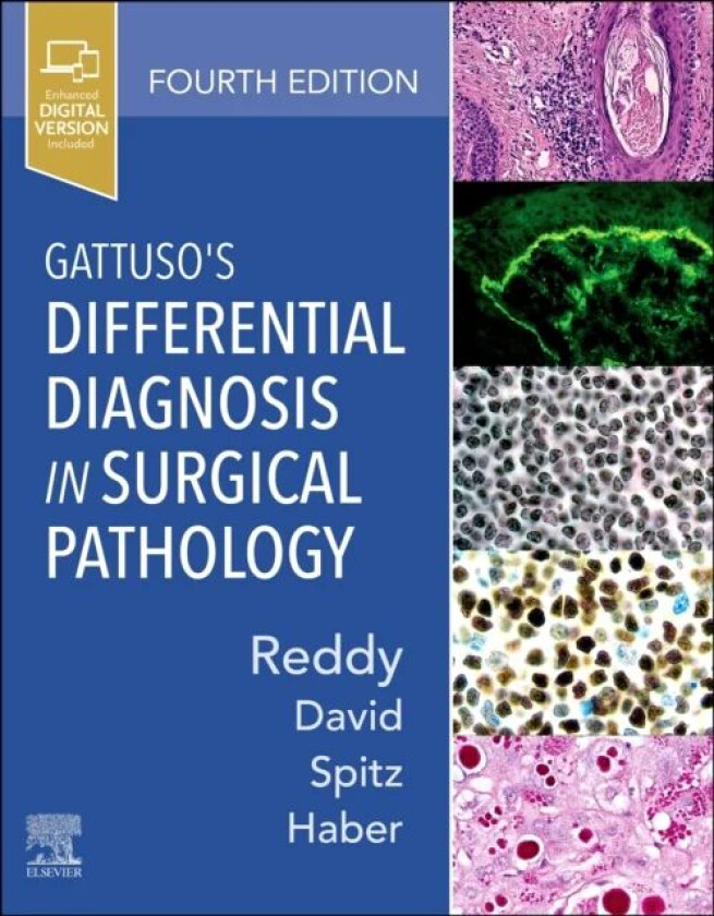 Gattuso's Differential Diagnosis in Surgical Pathology av Vijaya B. (The Harriet Blair Borland Chair Reddy