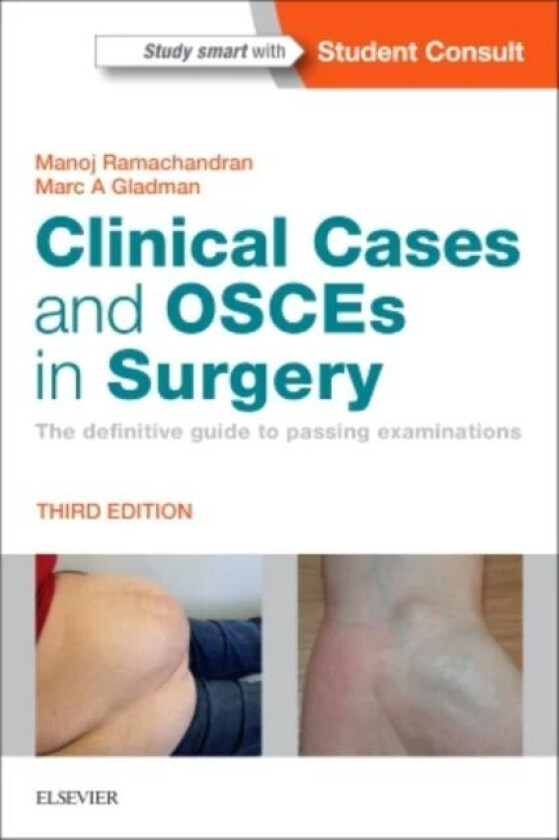 Clinical Cases and OSCEs in Surgery av Manoj Ramachandran, Marc A MBBS DRCOG D Gladman
