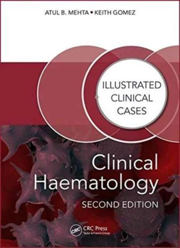 Clinical Haematology av Atul Bhanu (Consultant Haematologist Royal Free Hospital London UK) Mehta, Keith Gomez
