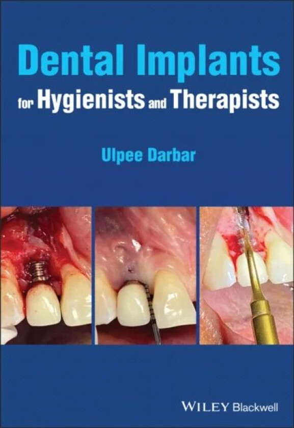 Dental Implants for Hygienists and Therapists av Ulpee R. (Eastman Dental Hospital London UK) Darbar