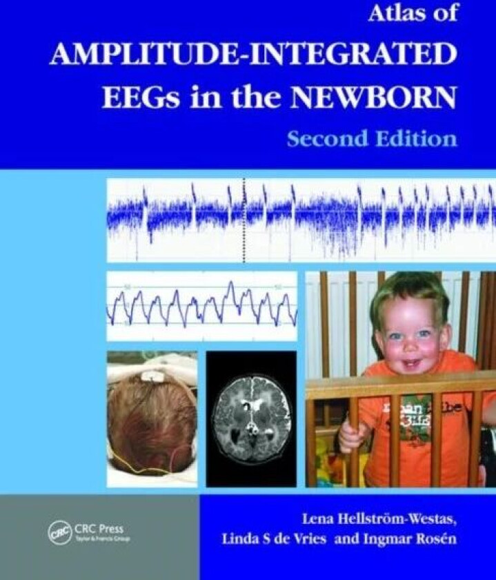 An Atlas of Amplitude-Integrated EEGs in the Newborn