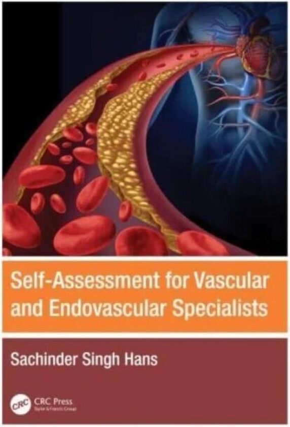 Self-Assessment for Vascular and Endovascular Specialists av Sachinder Singh (Henry Ford Macomb Hospital USA St. John Macomb Hospital USA Wayne State
