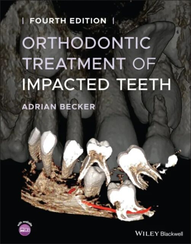 Orthodontic Treatment of Impacted Teeth av Adrian (Department of Orthodontics at the Hebrew University-Hadassah School of Dental Medicine Jerusalem) B