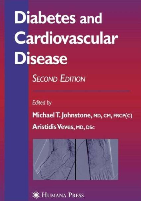 Diabetes and Cardiovascular Disease