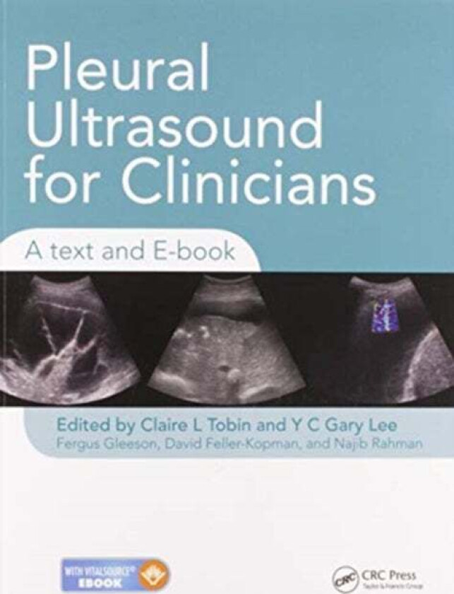 Pleural Ultrasound for Clinicians