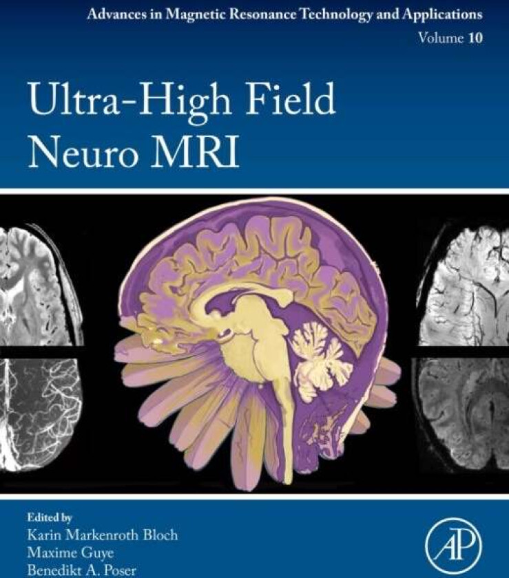 Ultra-High Field Neuro MRI