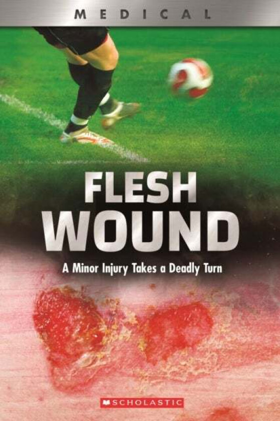Flesh Wound: A Minor Injury Takes a Deadly Turn (XBooks) av Shea Phillips