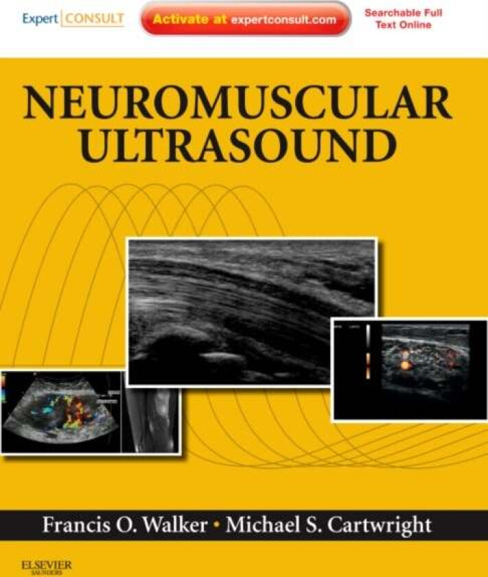 Neuromuscular Ultrasound av Francis (Professor of Neurology Wake Forest University School of Medicine Winston-Salem NC) Walker, Michael S. (Assistant