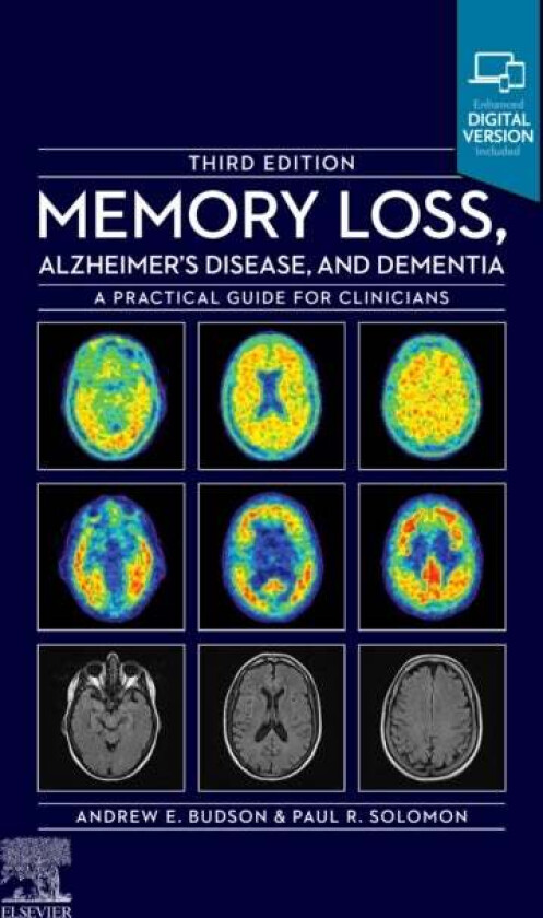Memory Loss, Alzheimer's Disease and Dementia av Andrew E. (Chief Cognitive & Behavioral Neurology and Associate Chief of Staff for Education