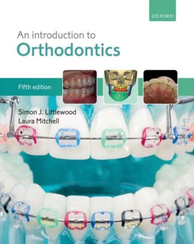 An Introduction to Orthodontics av Simon J. (Consultant Orthodontist and Specialty Lead Consultant Orthodontist and Specialty Lead St. Luke's Hos