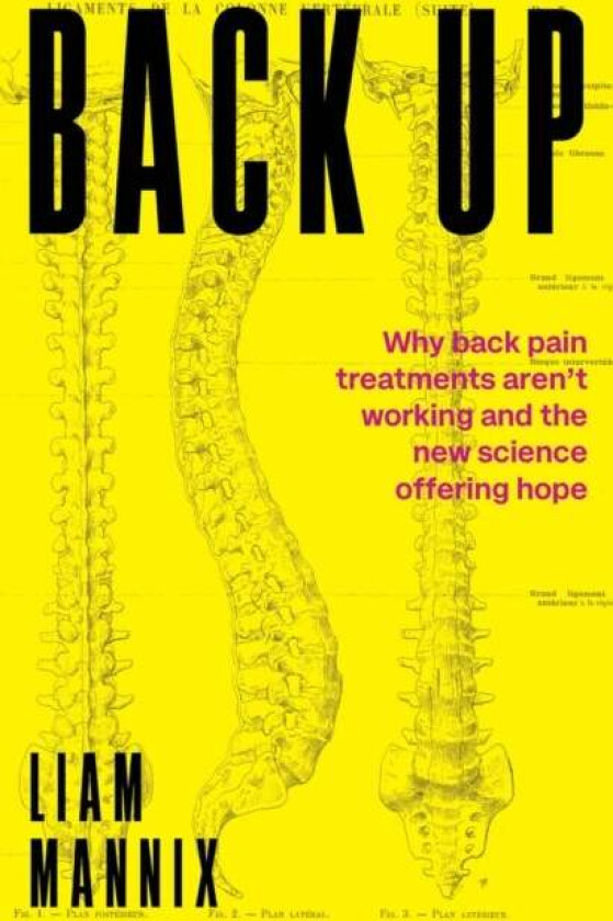 Back Up av Liam Mannix