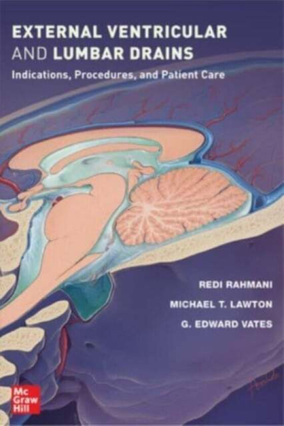 External Ventricular and Lumbar Drains: Indications, Procedures, and Patient Care av Redi Rahmani, Michael T. Lawton, G. Edward Vates