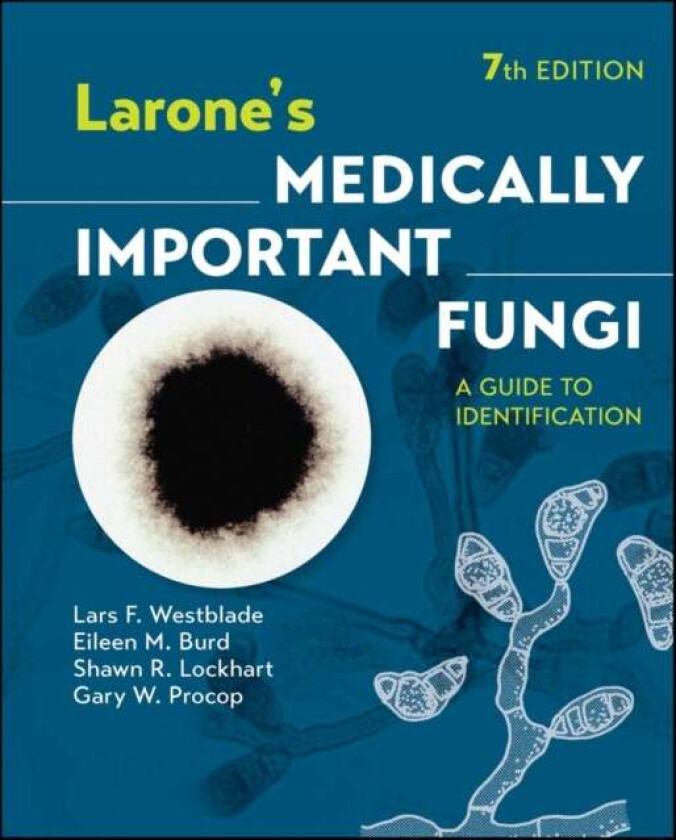 Larone's Medically Important Fungi av Lars F. (Weill Medical College of Cornell University Westblade, Washington University School of Medicine in