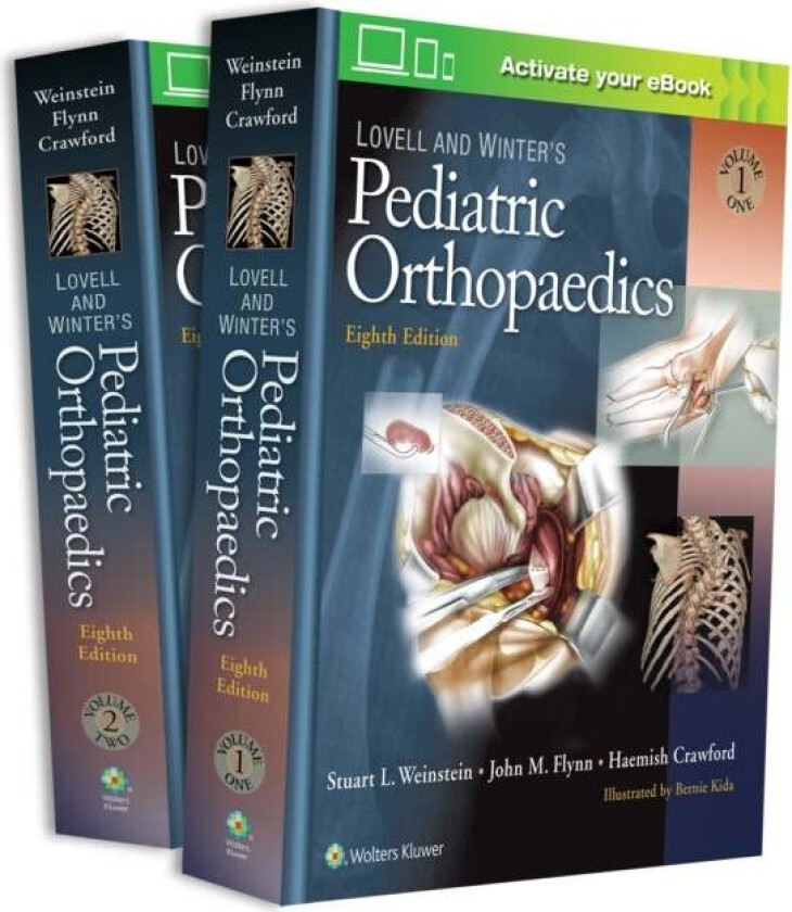 Bilde av Lovell and Winter's Pediatric Orthopaedics