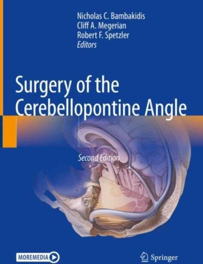 Surgery of the Cerebellopontine Angle