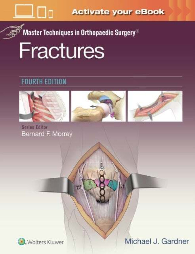 Master Techniques in Orthopaedic Surgery: Fractures av Michael J. Gardner