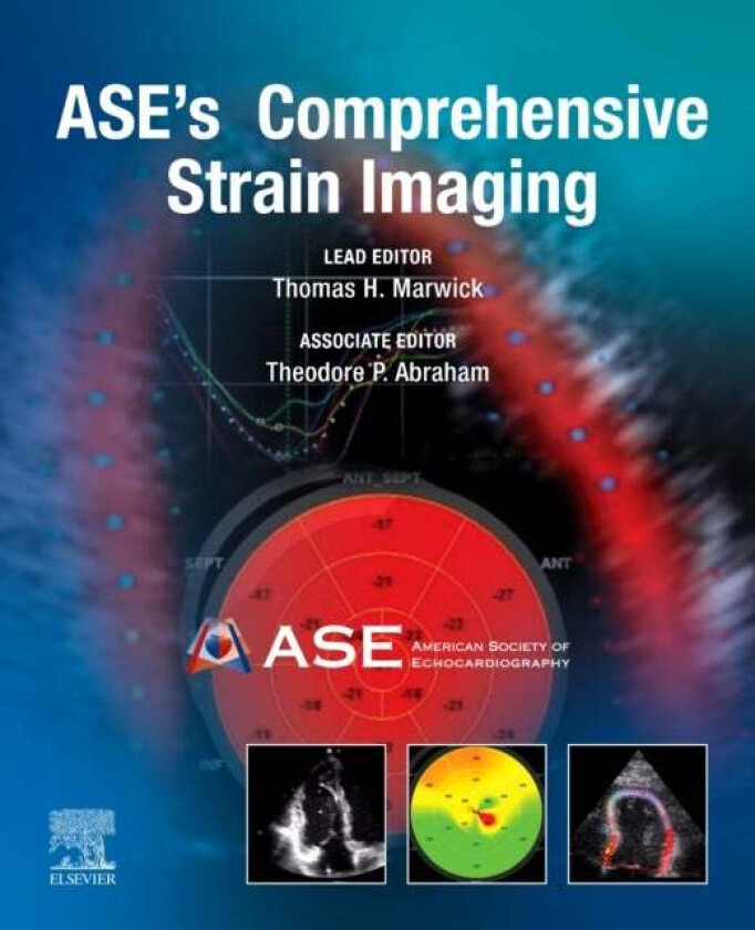 Bilde av ASE's Comprehensive Strain Imaging