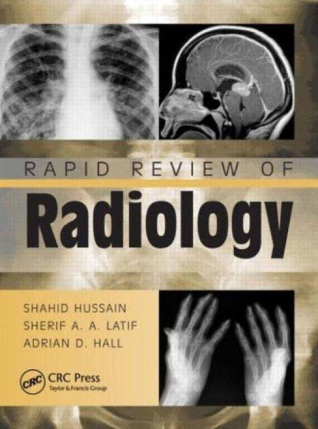 Rapid Review of Radiology av Shahid (Heart of England NHS Foundation Trust Heartlands Hospital Birmingham UK) Hussain, Sherif Aaron Abdel MRCS Latif,