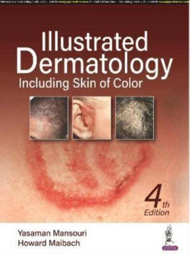 Illustrated Dermatology av Yasaman Mansouri, Howard Maibach