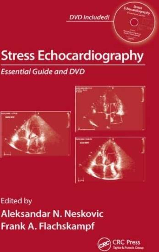 Stress Echocardiography