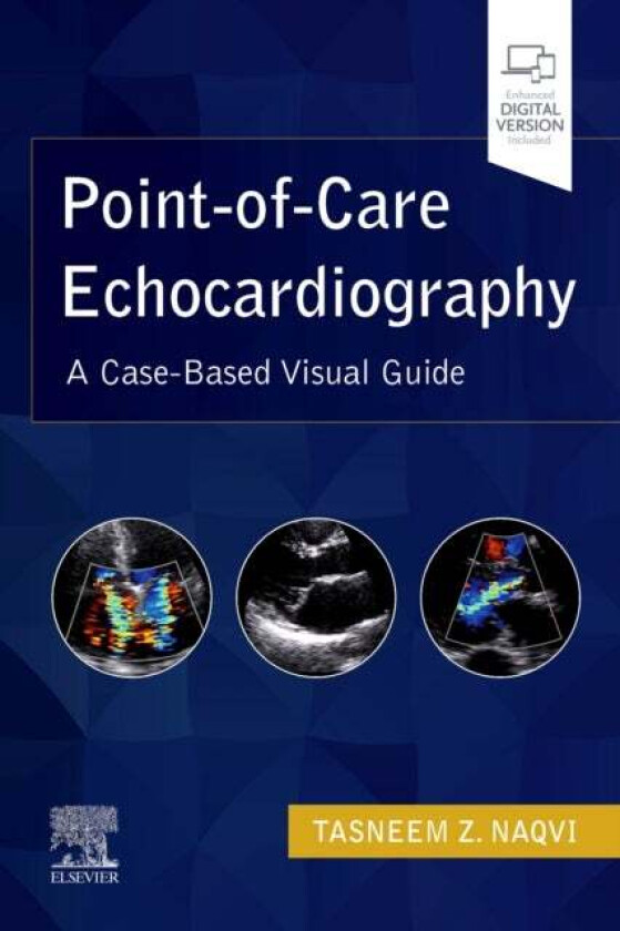 Point-of-Care Echocardiography av Tasneem Z. MD FRCP (Lon.UK) MMM FASE F Naqvi
