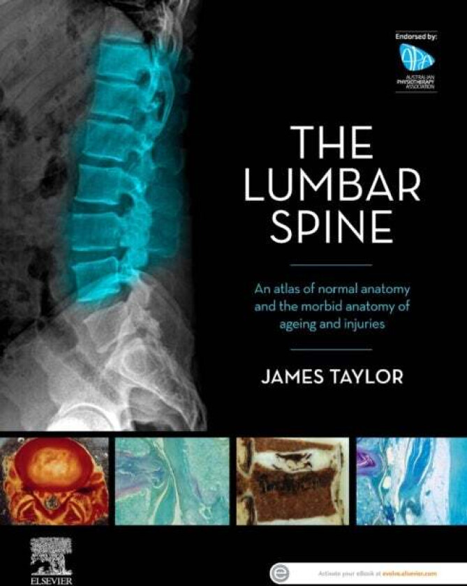 The Lumbar Spine av James Taylor