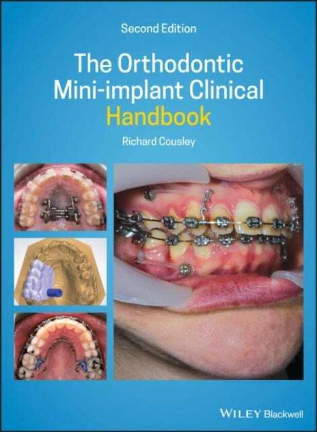 The Orthodontic Mini-implant Clinical Handbook av Richard (Consultant Orthodontist for the Peterborough & Stamford Hospitals NHS Foundation Trust)