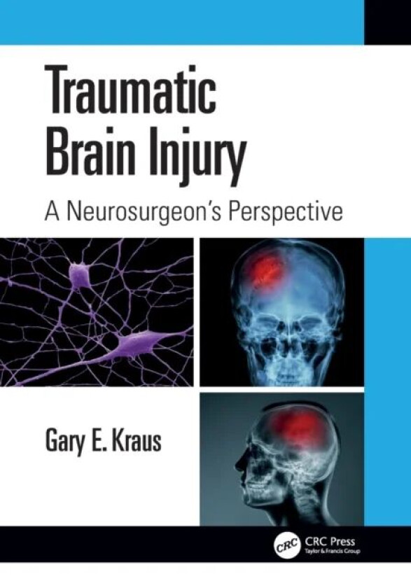 Traumatic Brain Injury: A Neurosurgeon's Perspective av Gary Kraus