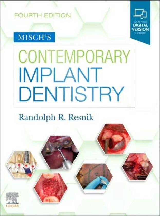 Bilde av Misch&#039;s Contemporary Implant Dentistry av Randolph (Private Practice Resnik Dental Implants Taylor MI Surgical Director Misch/Resnik Internationa