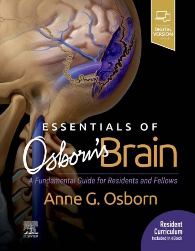 Essentials of Osborn's Brain av Anne G. MD (William H. and Patricia N. Child Presidential Endowed Chair Honoring Pioneering Utah Women in Medicin