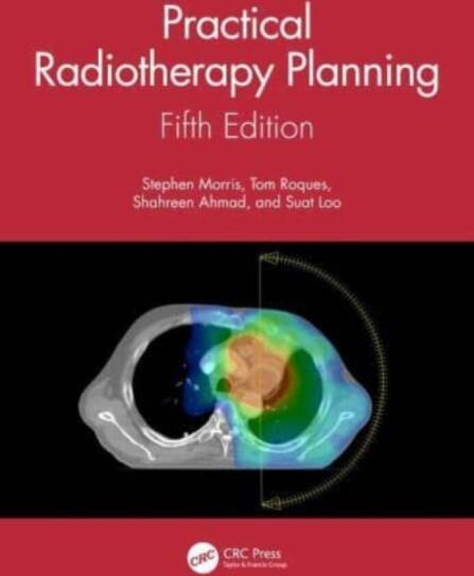 Practical Radiotherapy Planning av Stephen (Guy's and St Thomas' NHS Foundation Trust London) Morris, Tom (Norfolk and Nowrich University Ho