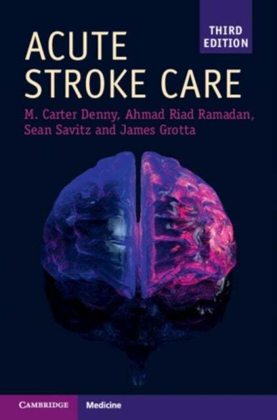 Acute Stroke Care av Mary Carter Denny, Ahmad Riad Ramadan, Sean I. (University of Texas Health Science Center Houston) Savitz, James Grotta