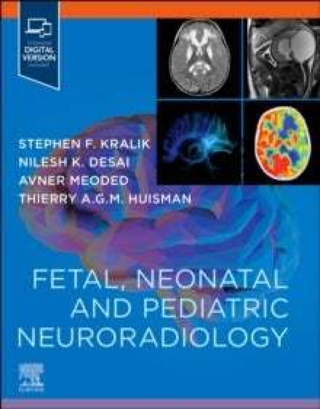 Fetal, Neonatal and Pediatric Neuroradiology av Stephen (Department of Radiology Texas Childrens Hospital Houston Texas USA) Kralik, Nilesh (Departmen