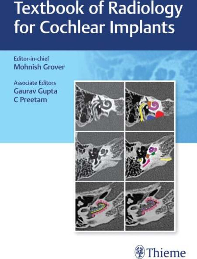 Textbook of Radiology for Cochlear Implants