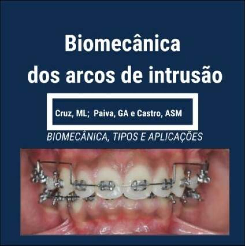 Biomecanica dos Arcos de Intrusao av Glauci Paiva, Agelita Castro, Mirna Liz Cruz
