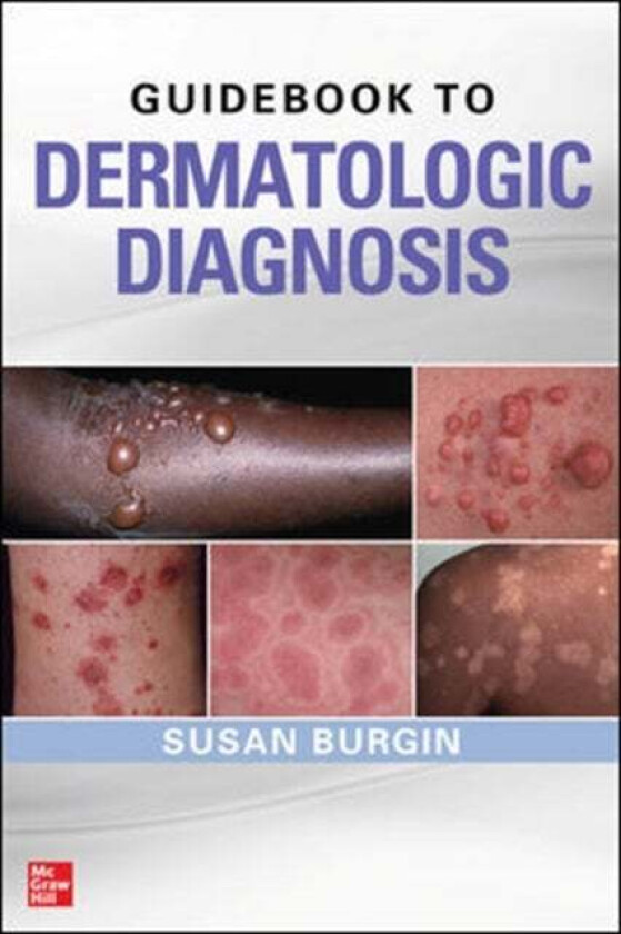 Guidebook to Dermatologic Diagnosis av Susan Burgin