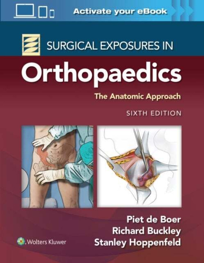 Bilde av Surgical Exposures in Orthopaedics: The Anatomic Approach av Dr. Piet MD de Boer, Richard MD FRCSC Buckley, Stanley Hoppenfeld