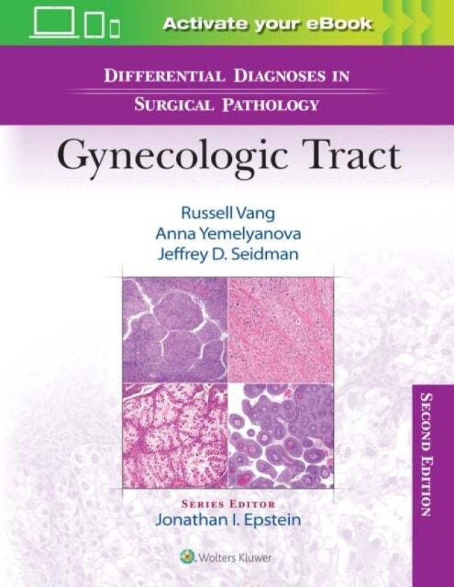 Bilde av Differential Diagnoses in Surgical Pathology: Gynecologic Tract av Russell Vang, Anna MD Yemelyanova, Jeffrey D. MD Seidman