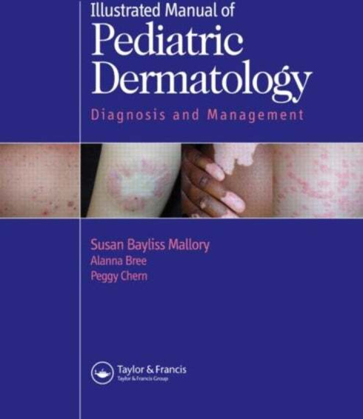 Illustrated Manual of Pediatric Dermatology av Susan Mallory, Alanna F. (St. Louis Missouri USA) Bree, Peggy (St. Louis Missouri USA) Chern